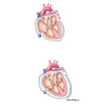 Pressure: Volume Relationship of Pericardium