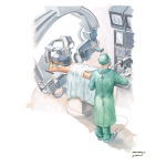 Acute Coronary Intervention