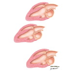 Doppler Techniques In Hemodynamic Evaluation