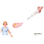 Assessment of Ovulation