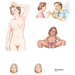 Abuse: Physical and Sexual