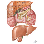 Congenital Anomalies - Liver