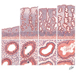 Endometrial Cycle