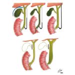 Function of Gallbladder and Choledochoduodenal Sphincter