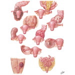 Conditions Simulating Ovarian Neoplasms - Differential Diagnosis