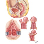Congenital Anomalies