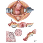 Congenital Anomalies I - Absence, Rudiments