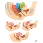 Uterus: Variations In Position 