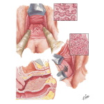 Malignant Tumors I - Primary