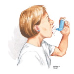 Pharmacologic Management in Asthma