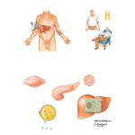 Metabolic Syndrome
