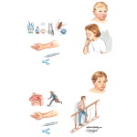 Asthma Classification