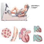 Functional Testing Exercise Radionuclear Ventriculograms (RVG)