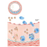 Atherogenesis: Fatty Streak Formation