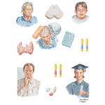Risk Factors for Alzheimer's Disease