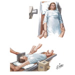 Radiographic Examination of Cervical Spine