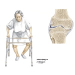 Knee