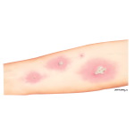 Adjunctive Diagnostic Testing in Asthma