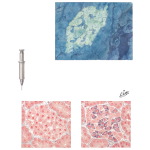 Demonstration of Insulin in the Pancreatic Islets