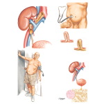 Late Complications of Renal Transplantation