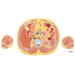 Abdomen: Origins of Celiac Artery and Portal Vein