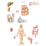Complications Common to All Transplantations