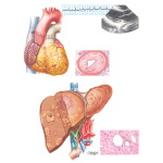 Organ-Specific Complications