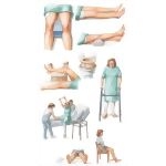 Rehabilitation After Total Hip Replacement