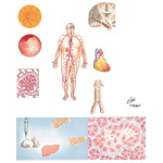 Microvascular and Macrovascular Complications In Diabetes