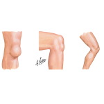 Physical Exam of the Leg and Knee