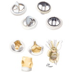 Second Generation of Synthetic Prosthetic Valves and Biologic Valves