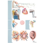 Predisposing Factors for Pulmonary Embolism