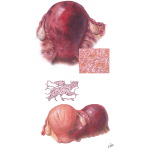 Couvelarie Uterus