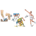 Medical History of the Leg and Knee