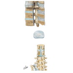 Spine: Ligaments