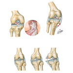 Disorders of the Leg and Knee