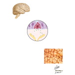 Irritable Bowel Syndrome - Enteric Sensory Neurons
