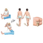 Physical Exam of the Pelvis