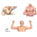 Medical History of the Shoulder