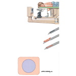 Diagnostic and Prognostic Techniques
