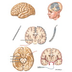 Preoperative Evaluation