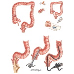 Screening Techniques 