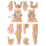 Surgical Approaches to Hand and Finger