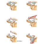 Stages of Acromioclavicular Dislocation