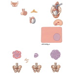 Androgen Deprivation in Metastatic Disease