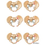 Classification of Pelvic Fractures