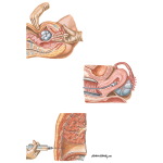 Preoperative Evaluation of Pelvic Mass