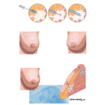 Clinical Signs of Cancer
