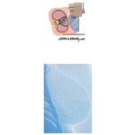 Mammography