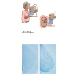 Mammography